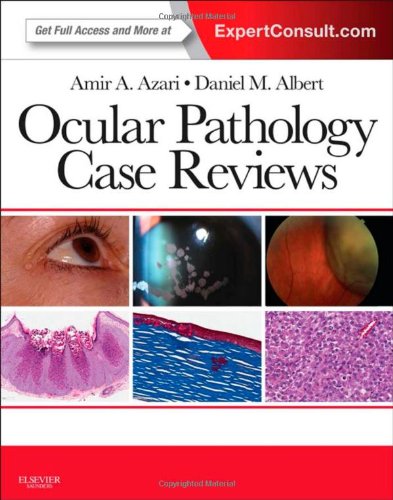 Ocular Pathology Case Reviews: Expert Consult - Online and Print 2015