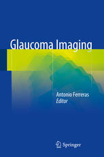 Glaucoma Imaging 2015