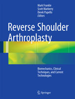 Reverse Shoulder Arthroplasty: Biomechanics, Clinical Techniques, and Current Technologies 2015