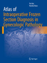 Atlas of Intraoperative Frozen Section Diagnosis in Gynecologic Pathology 2015
