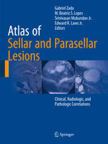 Atlas of Sellar and Parasellar Lesions: Clinical, Radiologic, and Pathologic Correlations 2015