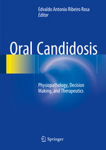 Oral Candidosis: Physiopathology, Decision Making, and Therapeutics 2015