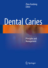 پوسیدگی دندان: اصول و مدیریت