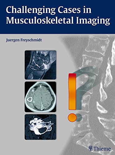 Challenging Cases in Musculoskeletal Imaging 2015