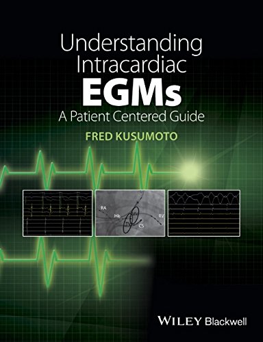 Understanding Intracardiac EGMs: A Patient Centered Guide 2015