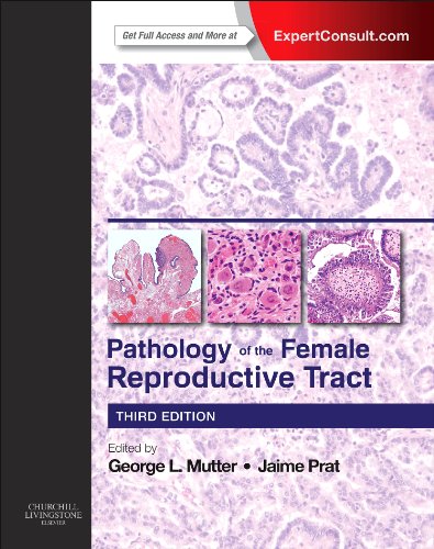 Pathology of the Female Reproductive Tract 2014