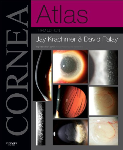 Cornea Atlas 2013