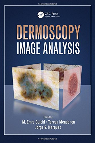 Dermoscopy Image Analysis 2015