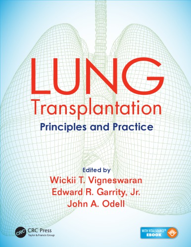 Lung Transplantation: Principles and Practice 2016