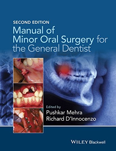Manual of Minor Oral Surgery for the General Dentist 2015