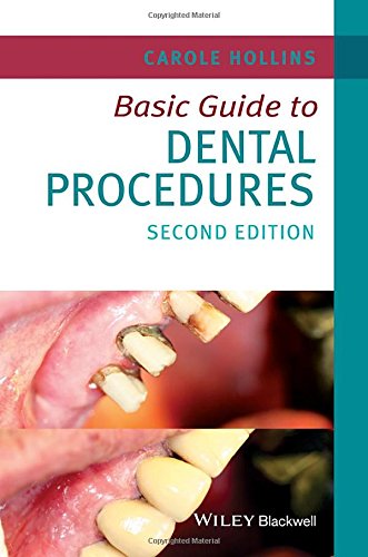Basic Guide to Dental Procedures 2015