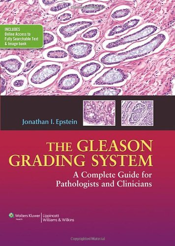 The Gleason Grading System: A Complete Guide for Pathologist and Clinicians 2013