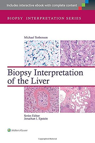 Biopsy Interpretation of the Liver 2014