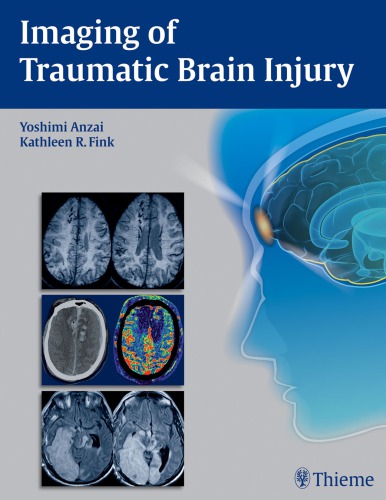 Imaging of Traumatic Brain Injury 2015