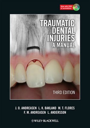 آسیب های تروماتیک دندان: شواهد