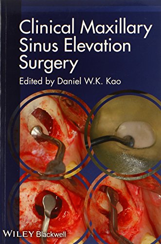 Clinical Maxillary Sinus Elevation Surgery 2014