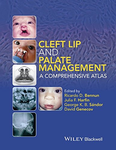 Cleft Lip and Palate Management: A Comprehensive Atlas 2015