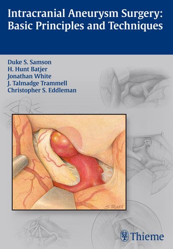 Intracranial Aneurysm Surgery: Basic Principles and Techniques 2012