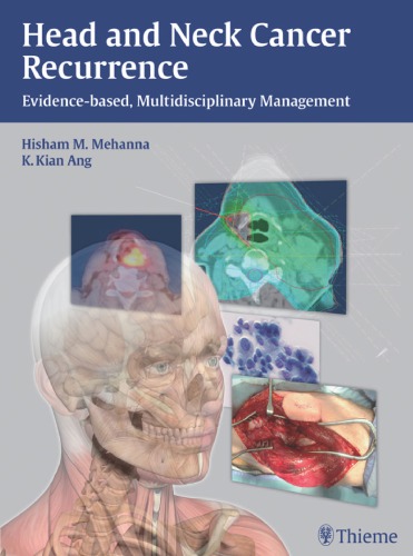 Head and Neck Cancer Recurrence: Evidence-based, Multidisciplinary Management 2012