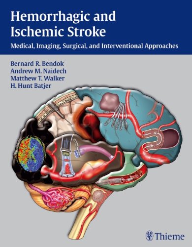 Hemorrhagic and Ischemic Stroke: Medical, Imaging, Surgical and Interventional Approaches 2012