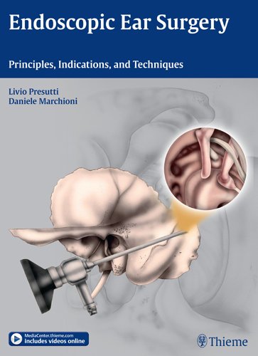 Endoscopic Ear Surgery: Principles, Indications, and Techniques 2014