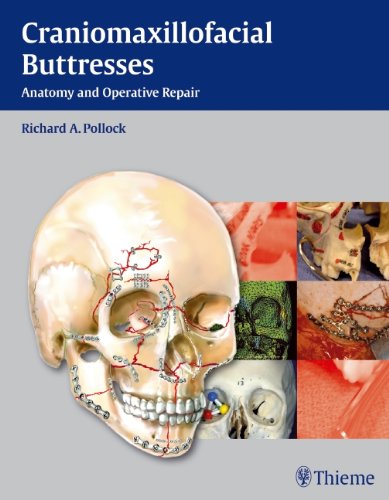 Craniomaxillofacial Buttresses: Anatomy and Operative Repair 2012