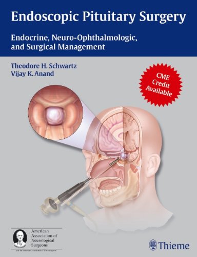 Endoscopic Pituitary Surgery: Endocrine, Neuro-ophthalmologic, and Surgical Management 2012