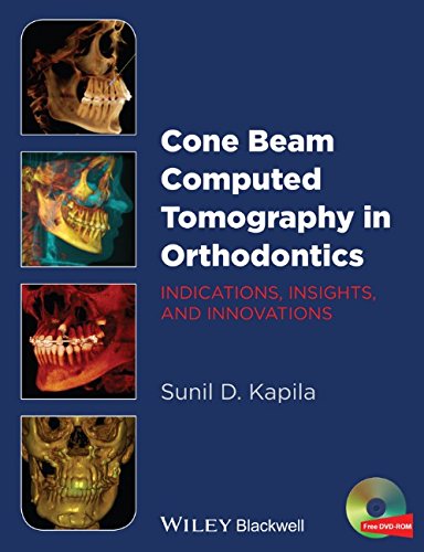 Cone Beam Computed Tomography in Orthodontics: Indications, Insights, and Innovations 2014