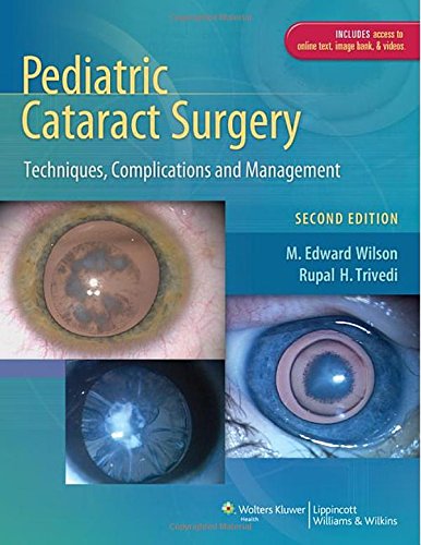 Pediatric Cataract Surgery: Techniques, Complications and Management 2014