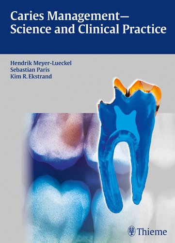 Caries Management: Science and Clinical Practice 2013