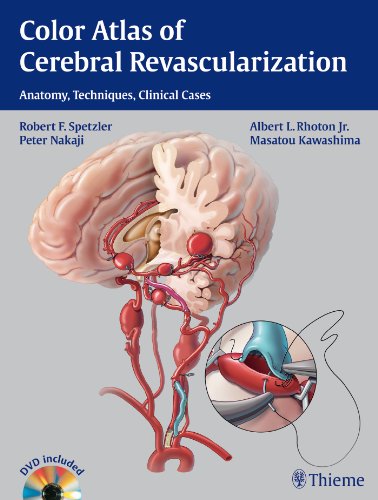 Color Atlas of Cerebral Revascularization: Anatomy, Techniques, Clinical Cases 2013