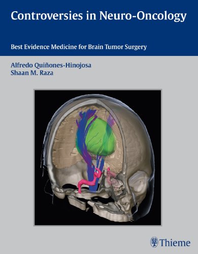 Controversies in Neuro-Oncology: Best Evidence Medicine for Brain Tumor Surgery 2013