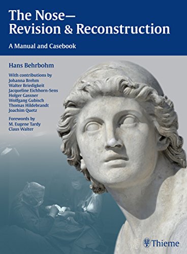 The Nose - Revision and Reconstruction: A Manual and Casebook 2015