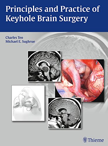 Principles and Practice of Keyhole Brain Surgery 2015