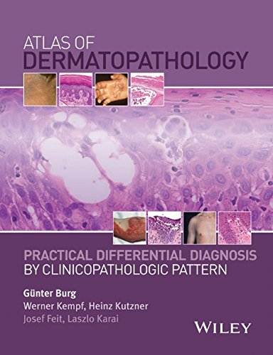 Atlas of Dermatopathology: Practical Differential Diagnosis by Clinicopathologic Pattern 2015