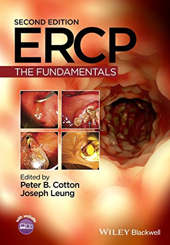 ERCP: The Fundamentals 2015