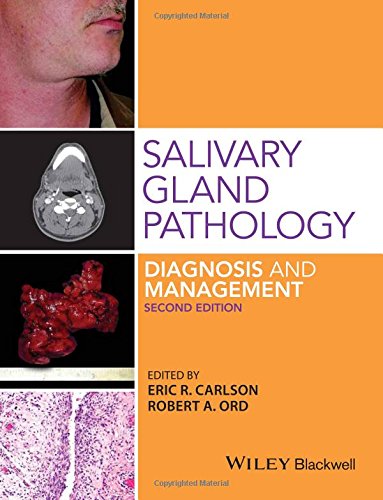 Salivary Gland Pathology: Diagnosis and Management 2015