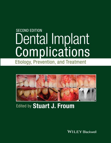 Dental Implant Complications: Etiology, Prevention, and Treatment 2015