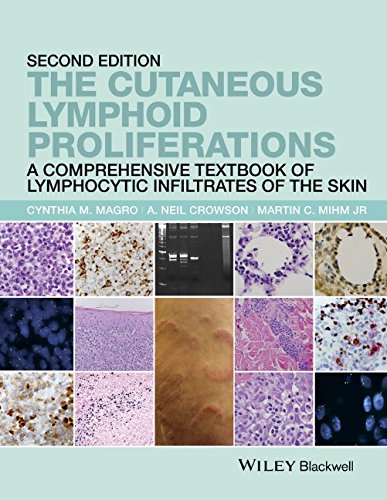 The Cutaneous Lymphoid Proliferations: A Comprehensive Textbook of Lymphocytic Infiltrates of the Skin 2016