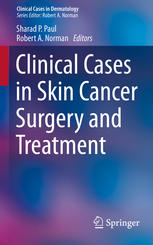 Clinical Cases in Skin Cancer Surgery and Treatment 2015