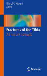 Fractures of the Tibia: A Clinical Casebook 2015