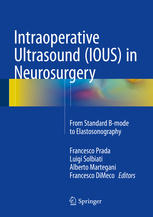 Intraoperative Ultrasound (IOUS) in Neurosurgery: From Standard B-mode to Elastosonography 2016