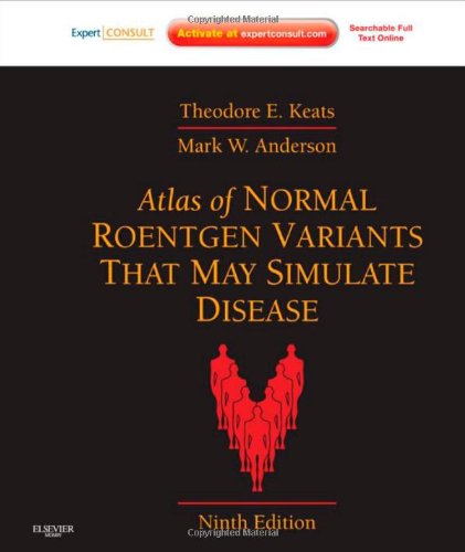 Atlas of Normal Roentgen Variants That May Simulate Disease: Expert Consult - Enhanced Online Features and Print 2012