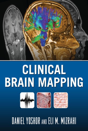 نقشه برداری مغز بالینی