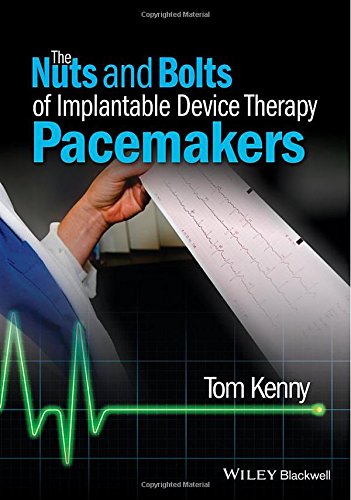The Nuts and Bolts of Implantable Device Therapy: Pacemakers 2015