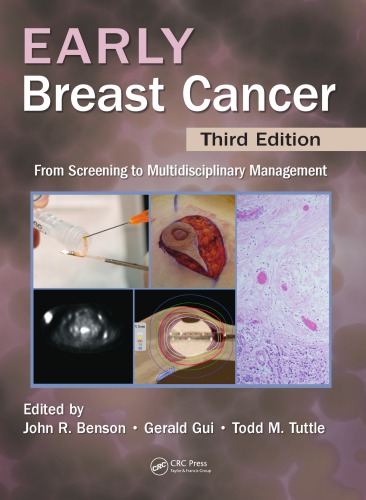 Early Breast Cancer: From Screening to Multidisciplinary Management, Third Edition 2013