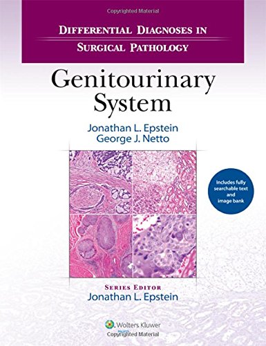 Differential Diagnoses in Surgical Pathology: Genitourinary System 2014