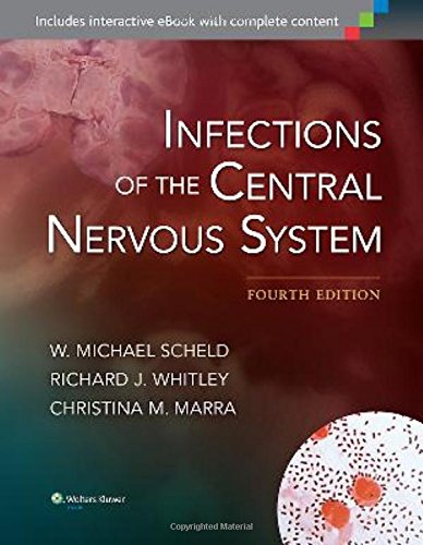 Infections of the Central Nervous System 2014