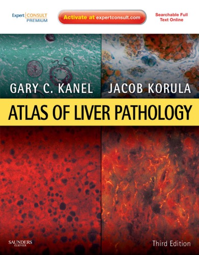 Atlas of Liver Pathology E-Book 2010