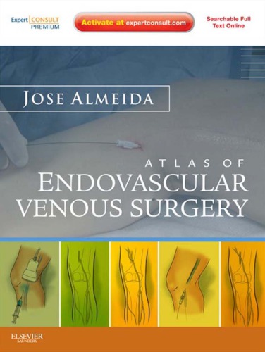 Atlas of Endovascular Venous Surgery 2011